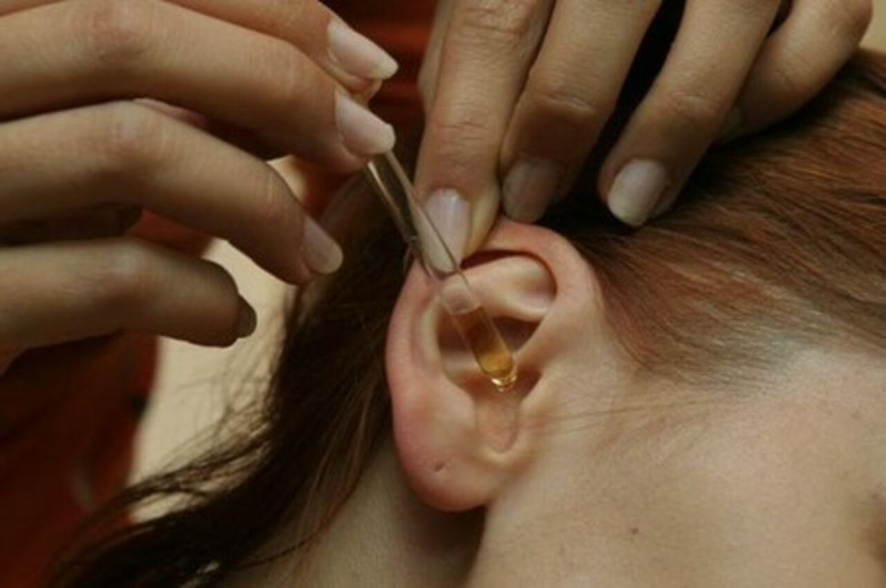 Как промывать ухо при отите 59 Как промывать ухо при отите 38