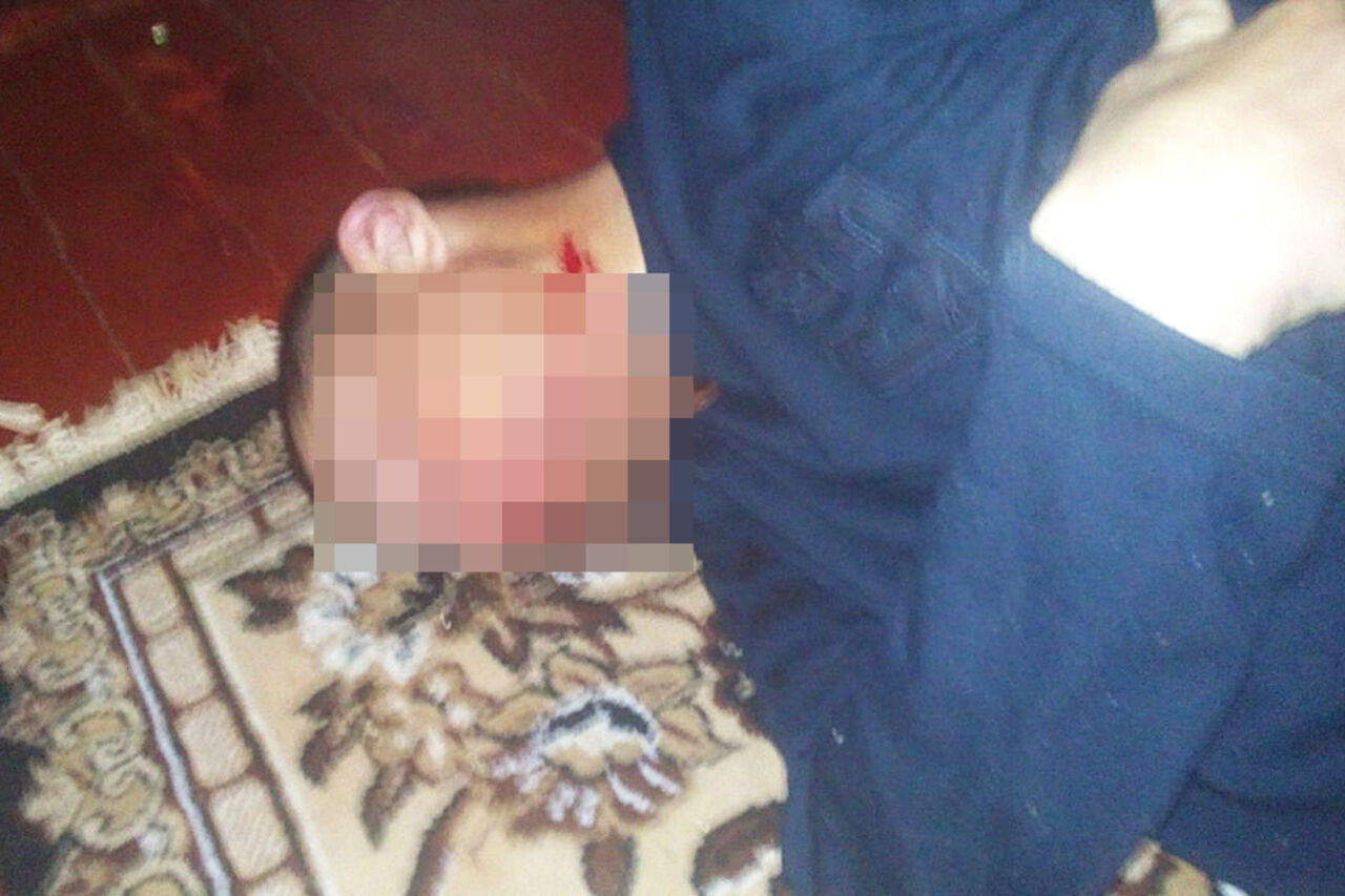В городе Пролетарске несовершеннолетние подозреваются в беспощадном избиении мужчины со смертельным исходом
