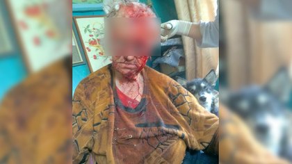 В Челябинской области пьяная женщина жестоко избила 90-летнюю труженицу тыла 
