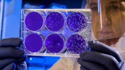 Ученые из Австралии вырастили копию коронавируса для борьбы со вспышкой в КНР