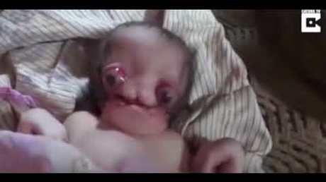 Прозванный «Чужим» младенец скончался в Индии