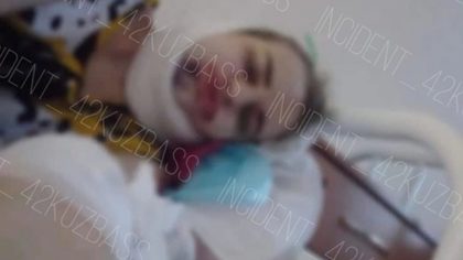 Девушка пострадала в ходе массовой драки в поселке Тяжинский