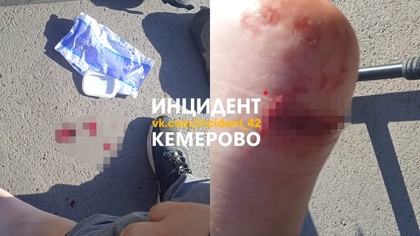Соцсети: ребенок пострадал после наезда электросамоката в Кемерове