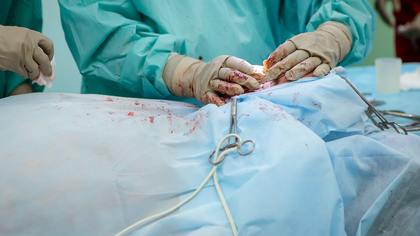 Хирурги нашли в теле волгоградца длинного червя после поездки на шашлыки
