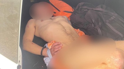 Мужчина сорвал с себя всю одежду в детской поликлинике в Краснодаре