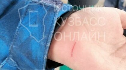 Ребенок поранился о сиденье троллейбуса в Кемерове