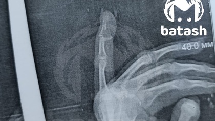 Мужчина сломал жене палец из-за документов на квартиру в Башкирии