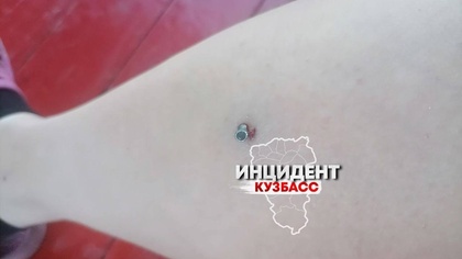 Жители Кузбасса во время стрельбы из ружья по мишеням случайно попали в соседку